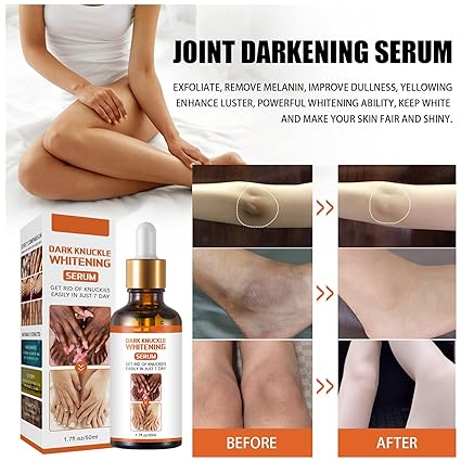 Skin Whitening Oil,dark Knuckle Whitening Serum, Strong Whitening Serum Removing Dark Knuckle Finger Elbow and Knee (1 Bottle) - Image 4