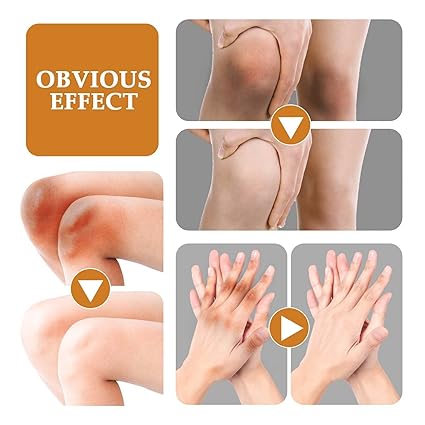 Skin Whitening Oil,dark Knuckle Whitening Serum, Strong Whitening Serum Removing Dark Knuckle Finger Elbow and Knee (1 Bottle) - Image 5