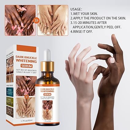 Skin Whitening Oil,dark Knuckle Whitening Serum, Strong Whitening Serum Removing Dark Knuckle Finger Elbow and Knee (1 Bottle) - Image 7