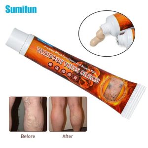 sumifun varicose veins treatment  cream   
