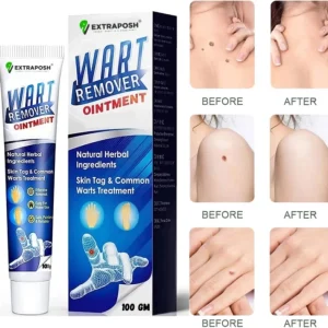 Wart Remover Ointmen Cream